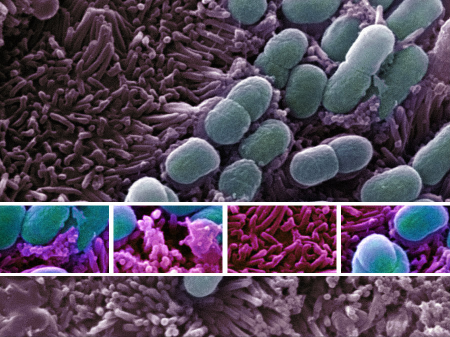 Πώς τακτοποιούν τα βακτήρια τις πρωτεΐνες τους! | Biology.gr