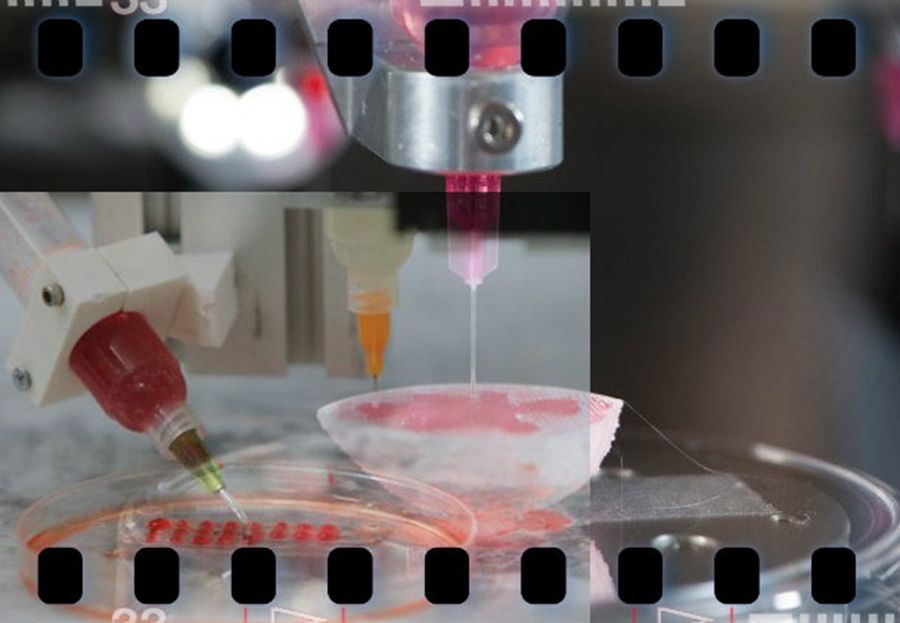 Τεχνητό αυτί πατώντας απλά "print"... | Biology.gr